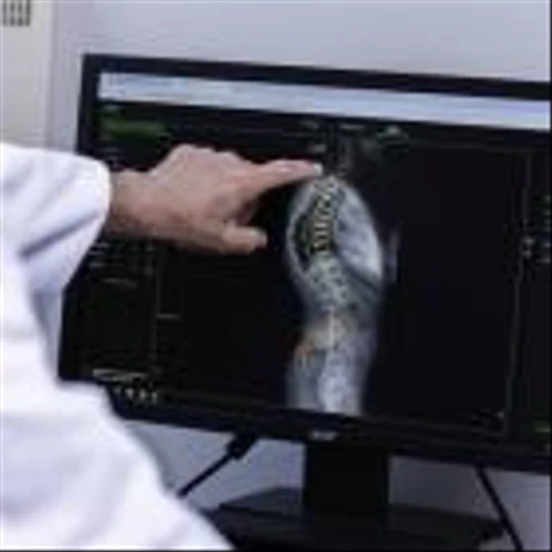 ATEC Launches EOS InsightTM, an End-To-End Spine Surgery Platform Powered by EOS Imaging and AI