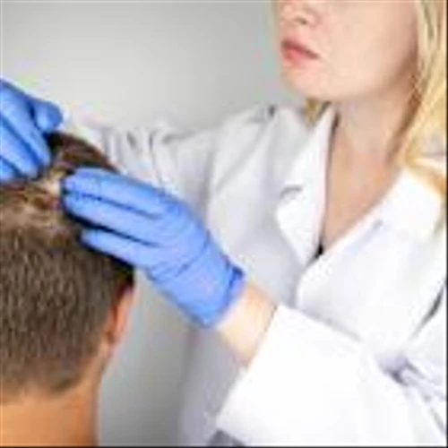 AbbVie seeks Rinvoq alopecia approval after second Phase III success