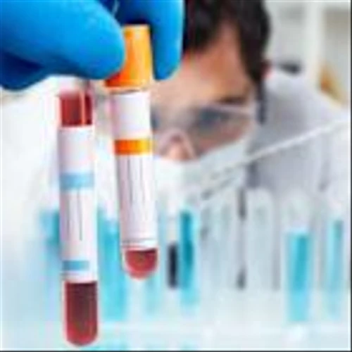Quest introduces blood test to confirm amyloid brain pathology in Alzheimer’s
