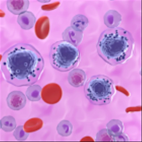 SELLAS’ CDK9 inhibitor to advance after “exceeding expectations” in AML