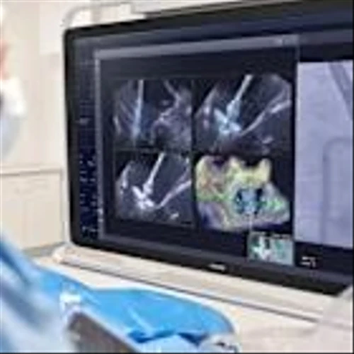 Philips wins FDA clearance for imaging device developed with Edwards