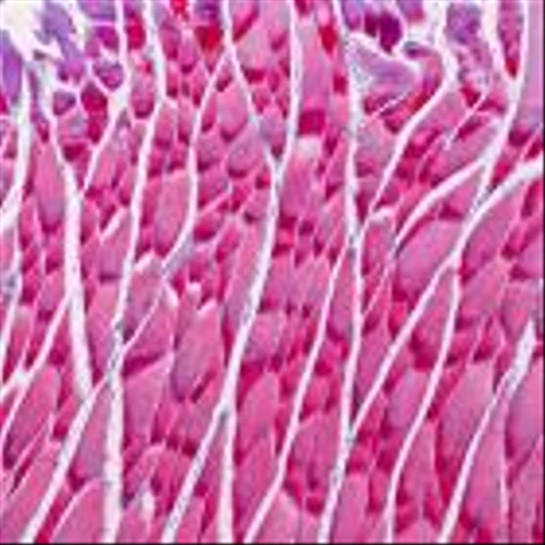 Muscle-building drug improves body composition in obesity trial, Veru says
