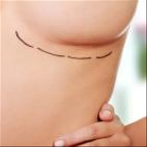 15 Countries with Most Breast Implants in the World