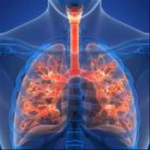 Why It's A New Day For COPD Patients — And Regeneron, Sanofi, Verona Stocks