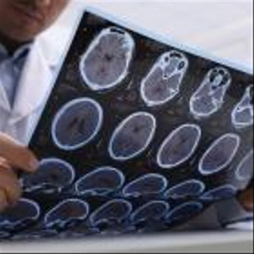 GT Medical secures venture loan to expand reach of brain tumour treatment
