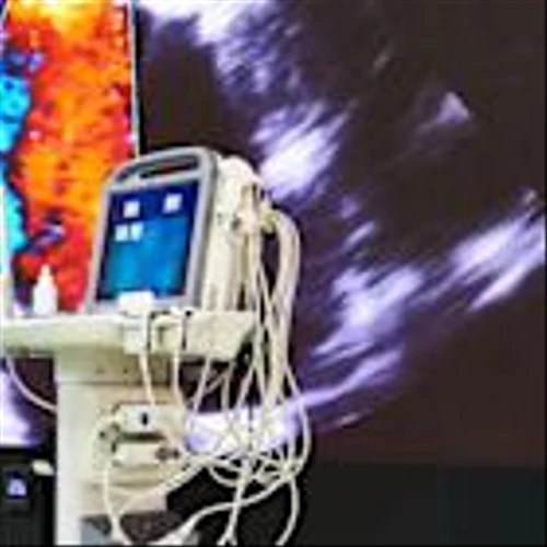 What Boston Scientific’s 34% Rally Means After Upbeat FDA Heart Device News