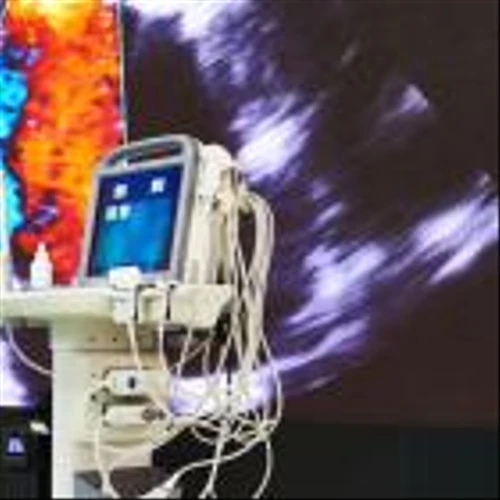We Think ReWalk Robotics (NASDAQ:RWLK) Needs To Drive Business Growth Carefully