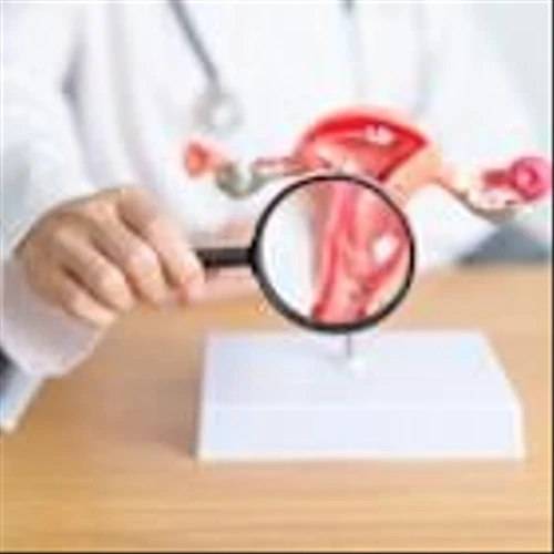 Verastem’s avutometinib combination shows 31% ORR in ovarian cancer trial