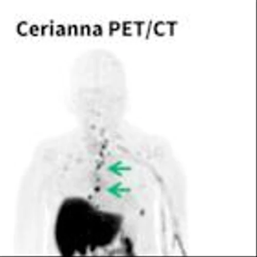 Updated NCCN Clinical Practice Guidelines in Oncology (NCCN Guidelines®) Recommend Use of FES PET Imaging for Lobular Breast Cancer