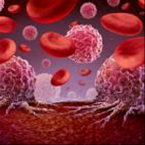 Actinium Pharmaceuticals reports data from Phase III trial of AML treatment