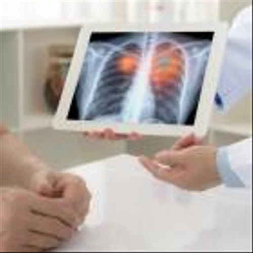 Genprex dosing subjects in trial of combination therapy for small-cell lung cancer