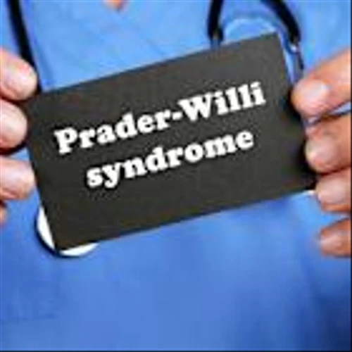 EMA validates Soleno’s application for Prader-Willi syndrome treatment