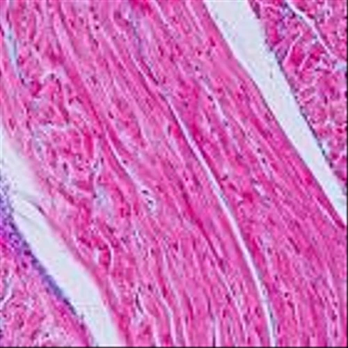 Immutrin raises $87M to advance drug for progressive heart disease