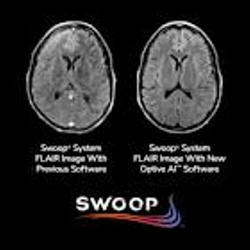Hyperfine Announces FDA Clearance of Optive AI™ Software, Introducing the Most Substantial Image Quality Improvement Ever for the Swoop® System