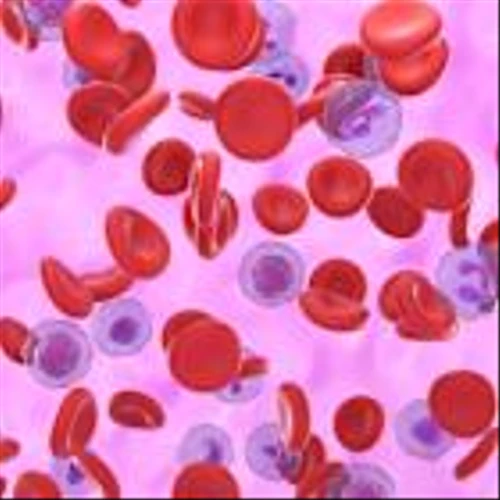 Ono pays $280M to license Ionis rare disease drug
