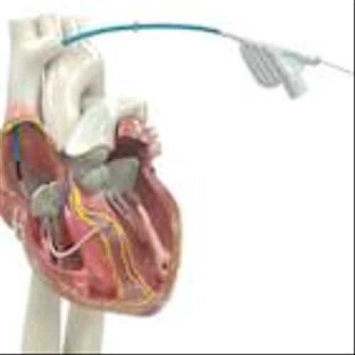 Medtronic OmniaSecure™ defibrillation lead is the first lead of its kind to receive FDA approval for conduction system pacing