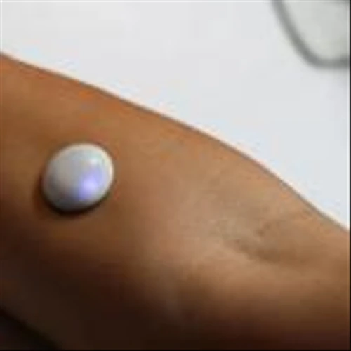 Biolinq gets FDA de novo nod for intradermal glucose sensor