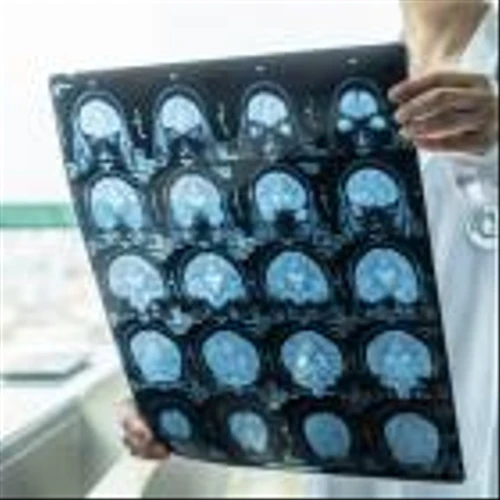 FDA grants fast track designation to Life Molecular Imaging’s tau PET diagnostic