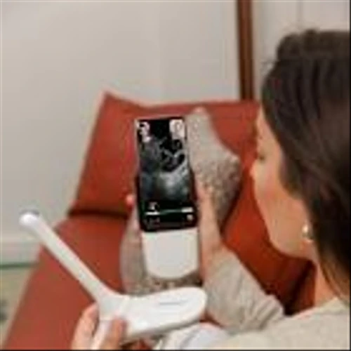 Pulsenmore and Clalit Health Services Launch First At-Home Follicular Monitoring Service for IVF and Fertility Preservation