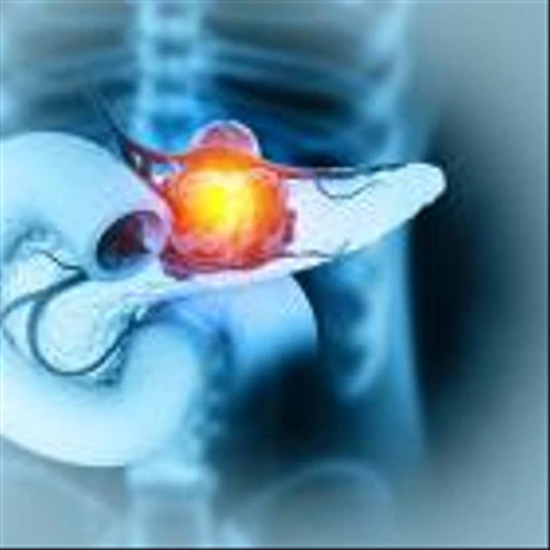 Oncolytics doses first subject in pancreatic cancer trial