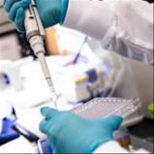 Moderna Swings to a Loss. The Stock Jumps Anyway.