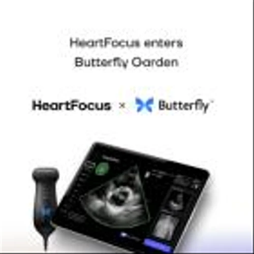 HeartFocus Joins Butterfly Garden to Develop Software Enabling Any Healthcare Professional to Conduct Lifesaving Echos on Butterfly’s Imaging Platform