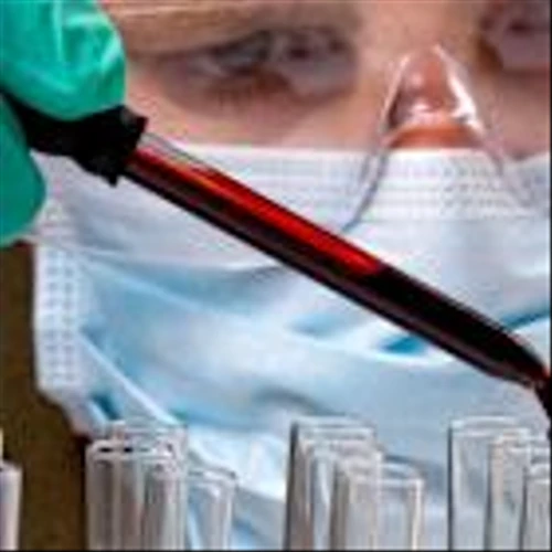 Zevra Therapeutics Crashes, Reversing 89% Run. Why It Could Be An 'Overreaction.'