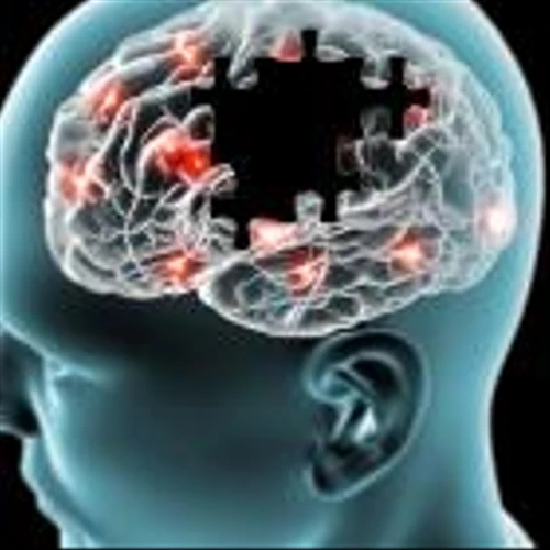 What's Going On With Alzheimer's-Focused Cassava Sciences On Tuesday?