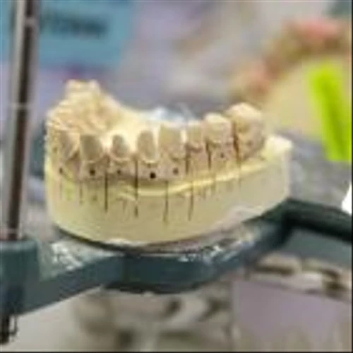 Dental Implant Maker ZimVie Weighs Potential Sale