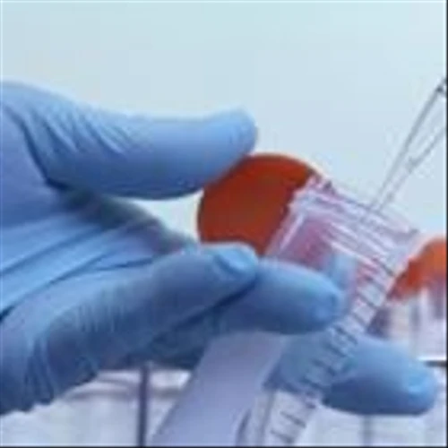 Top Analyst Reports for Merck, TotalEnergies & Union Pacific