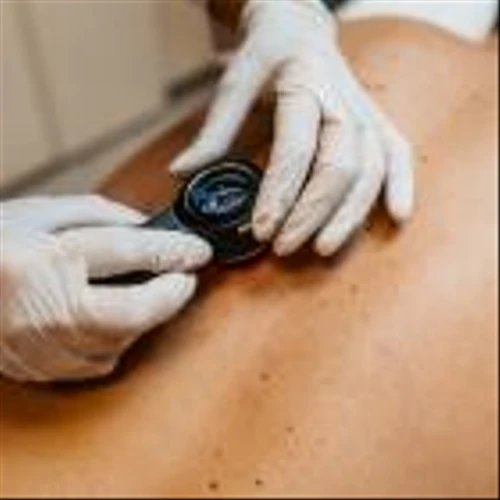 Replimune kickstarts Phase III melanoma trial studying RP1 immunotherapy