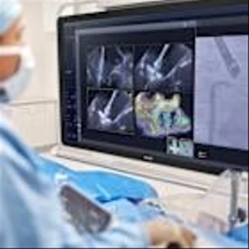 FDA clears Philips AI solution that provides real-time guidance during complex minimally invasive heart valve repair