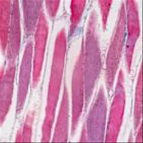 Muscle-sparing obesity drug safe for Phase 3 trial, Veru says