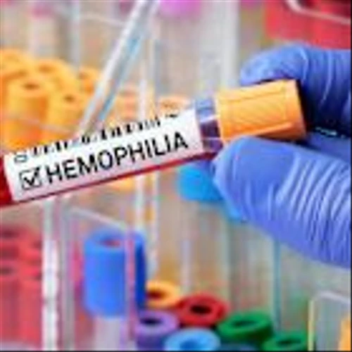 NMPA approves BBM and Takeda China’s haemophilia B therapy