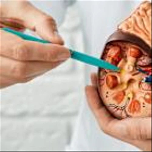 Biomerica’s kidney disease test gains approval for sale in UAE