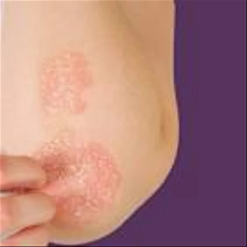 Sanofi’s Dupixent successor heads to regulators after Phase III success