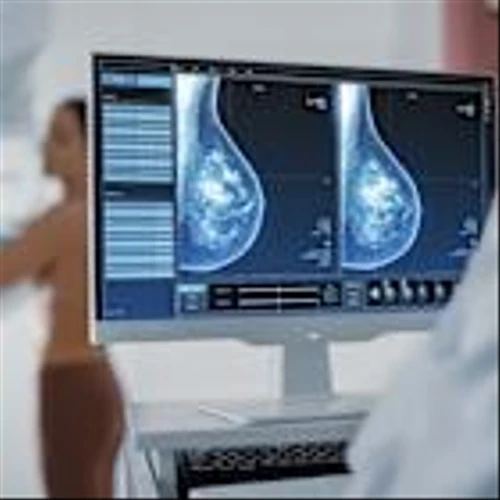iCAD and Microsoft join forces for AI mammography solutions
