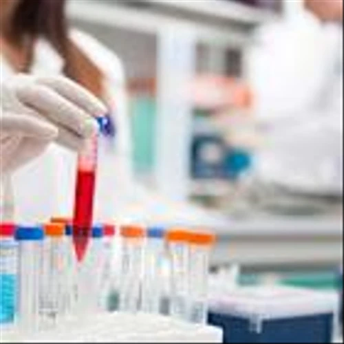 Top 1% Celcuity Stock Shoots To Record High On Roche-Rivaling Breast Cancer Results