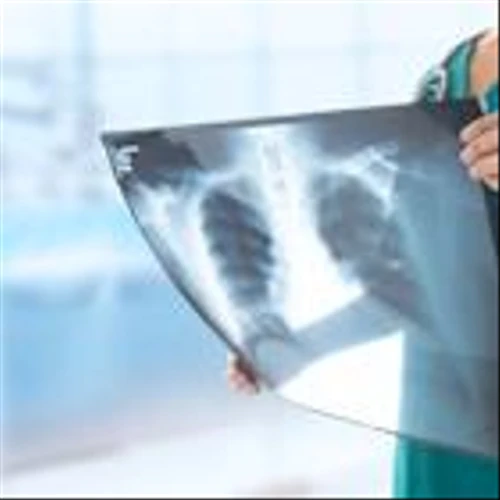 MAIA Biotechnology's Experimental Cancer Drug Shows Tripled Survival Vs. Standard Chemotherapy In Pretreated Lung Cancer Patients