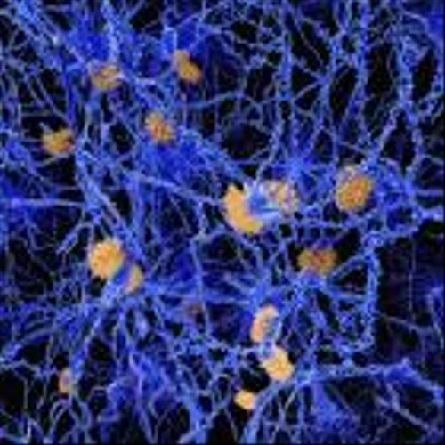 Athira exploring strategic alternatives after Alzheimer’s failure