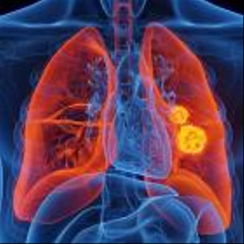 FDA grants breakthrough therapy status for Nuvalent’s NVL-655