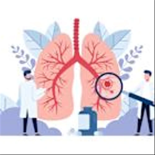 NSCLC: three trials to keep an eye on
