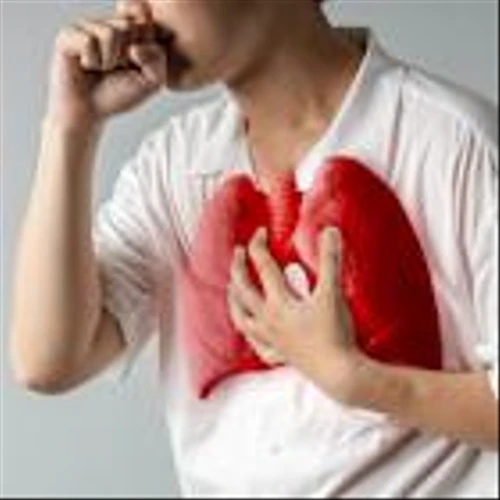 Trevi Therapeutics enrols all subjects in trial of Haduvio for chronic cough in IPF