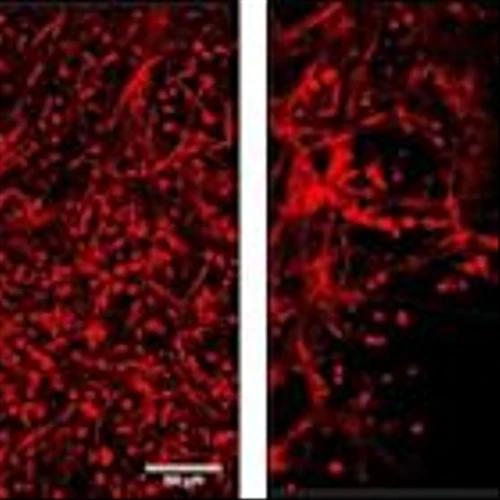 CollPlant's rhCollagen-Based BioInk Demonstrates Strong Performance Compared to Matrigel® in Study Conducted by Technion - Israel Institute of Technology