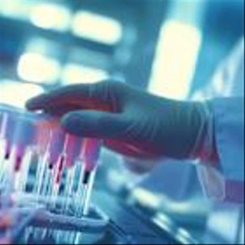 Should You be Optimistic on Bio-Rad Laboratories’s (BIO) Outlook?