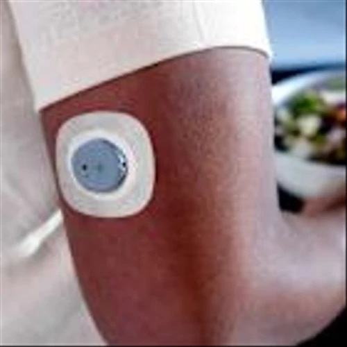 DexCom Is Doubling Down on Its ‘Mistake.’ Why It’s Time to Buy the Stock.
