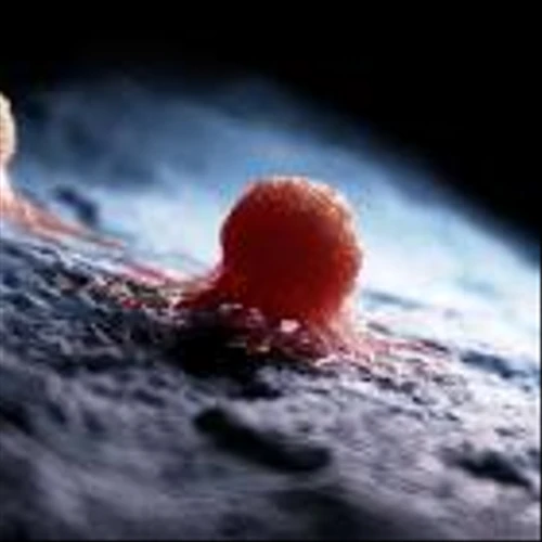 Aethlon Medical enrols first patient in trial of Hemopurifier device for cancer