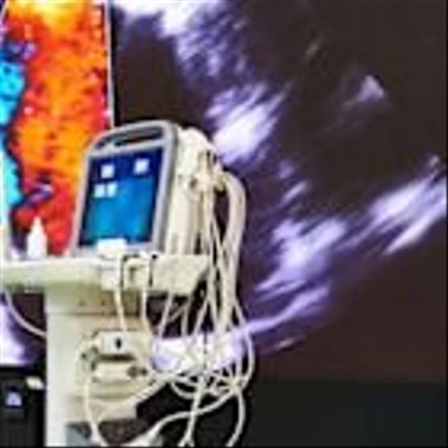GE HealthCare BARDA Expansion Highlights AI Ultrasound And Valuation Opportunity
