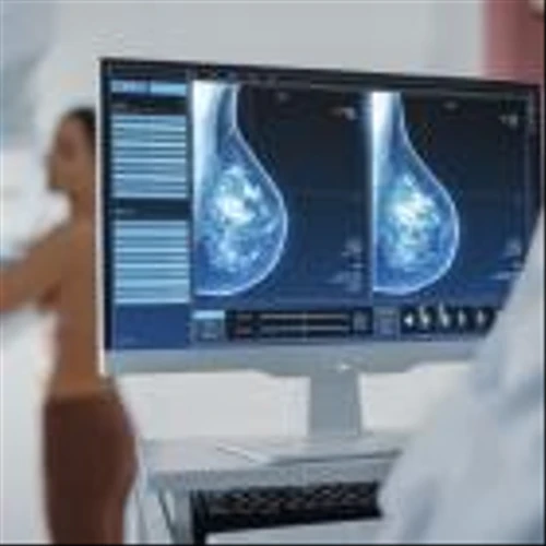IceCure’s cryoablation system for breast cancer treatment gains FDA panel support