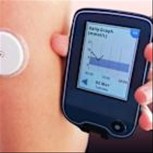 DXCM Stock Falls Despite FDA Clearance for Dexcom Smart Basal